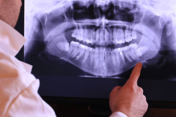 Best Dental Abscess Treatment in Cherokee, IA